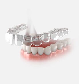 Care Aligners_New